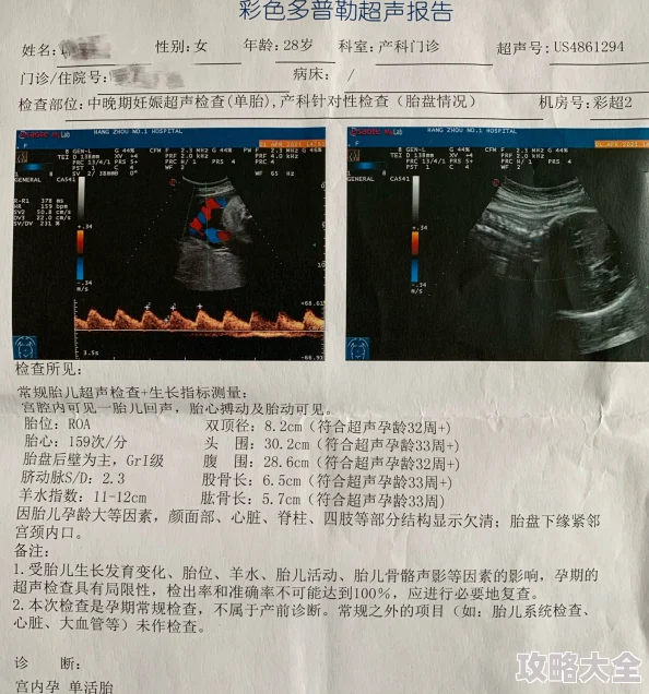 有孕1V2LH孕期已满三月胎儿稳定双胎发育良好